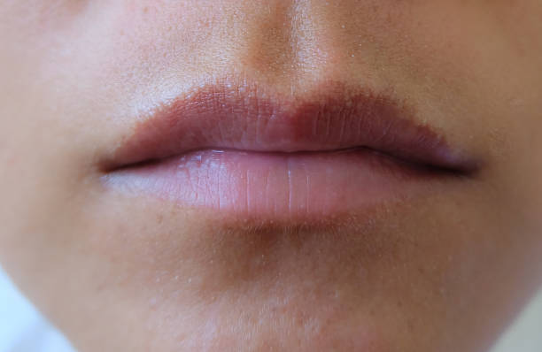 Close-up image of a person's lips showing natural skin texture