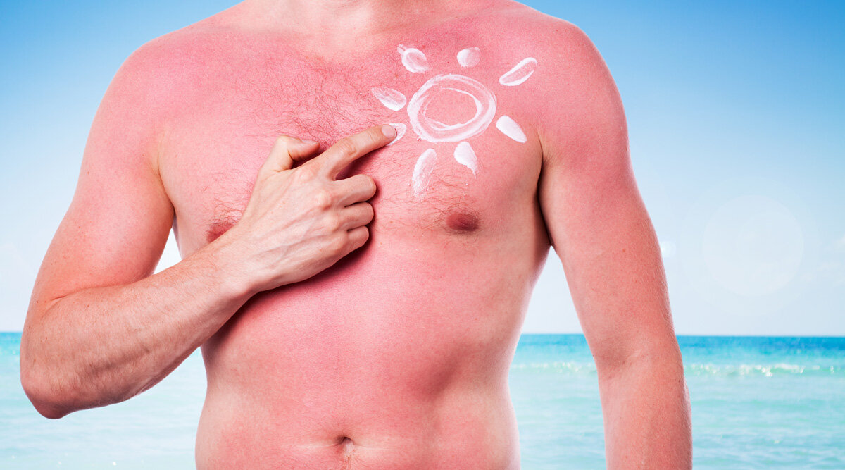 Effective techniques for sun damaged skin repair on chest