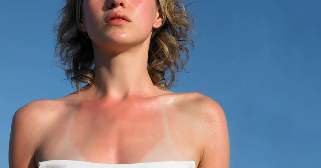 Restoring sun damaged chest skin with proven methods